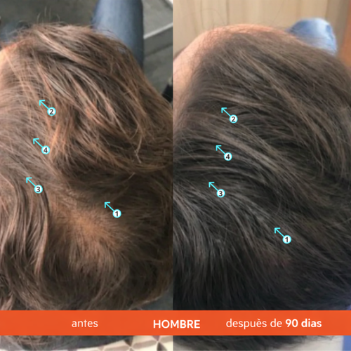 Champú Crecieminto Pelo