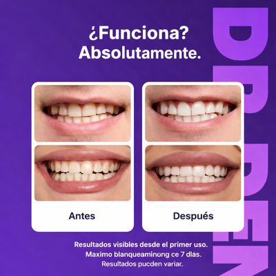 Tiras Blanqueadoras | Nuvra